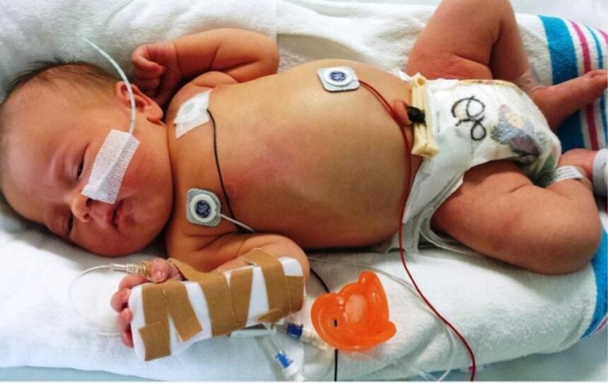 Triple amenaza de virus respiratorios ataca a los niños de Latinoamérica