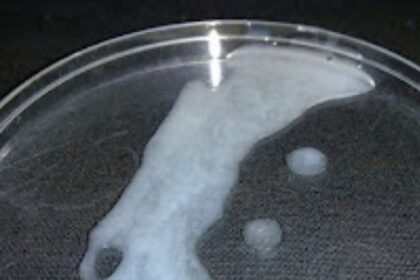 Por qué el semen tiene diferentes coloraciones, ¿es señal de alguna enfermedad o que no está sano?