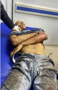 “El Mello”, “Brayan” y otra persona no identificada caen abatidos al enfrentar a agentes policiales
