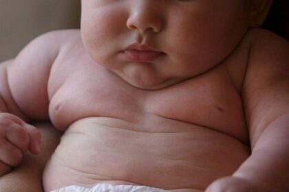 MD02 ESPANA OBESIDAD INFANTIL MD02 e1677922989947