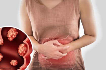 Sintomas de cancer de colon 768x439 1