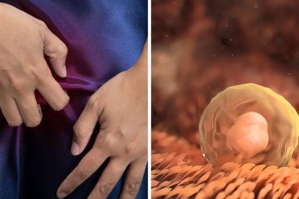 5 razones por las que se oscurece la vulva, ¿puede ser señal de cáncer?