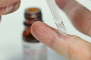 ¿Cómo reconocer una infección por molusco contagioso o VPH?