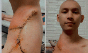 Un joven en Filipinas inspira y transmite esperanza a todos mientras lucha contra el cáncer