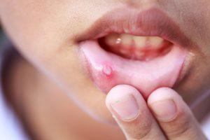 Qué daño causa tragarse el semen