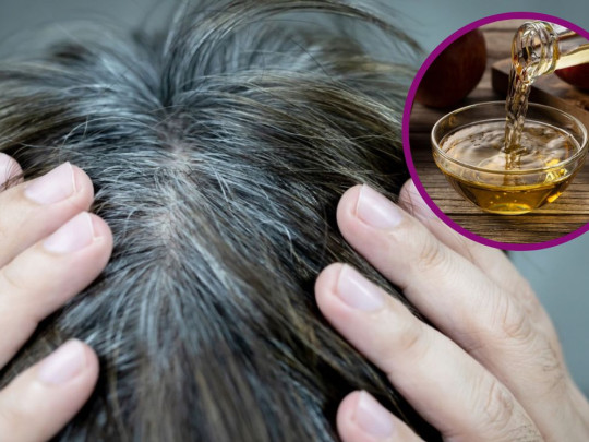 ¿Cómo usar el vinagre de manzana para eliminar las canas?