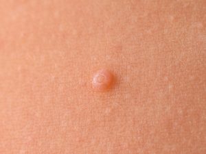 4 tipos de bultos que pueden salirte en la vagina y revelan más de lo que crees
