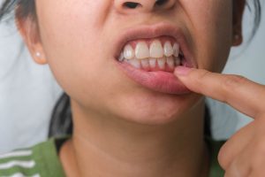 ¡Cuidado! Besar a alguien con mal aliento podría contagiarte del mismo mal