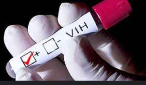 El 28% de los pacientes con VIH en RD son de nacionalidad haitiana