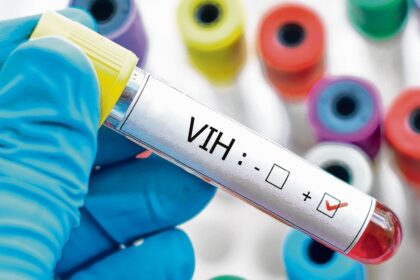 Santo Domingo concentra el 29.15% de casos confirmados de VIH