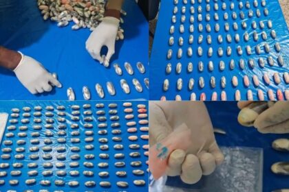 Detienen nigeriano con 134 bolsitas de cocaína en el estómago