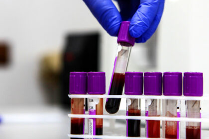 Inician en Rusia los primeros ensayos clínicos de una vacuna contra el cáncer