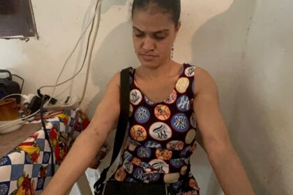 Mujer con neuropatía periférica denuncia presunta agresión sexual y física en La Cabirma, Cotuí