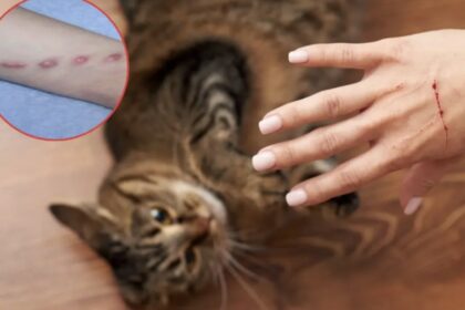 Fuera de Serie. : Muere en Turquía una niña tras contraer la rabia por el arañazo de un gato