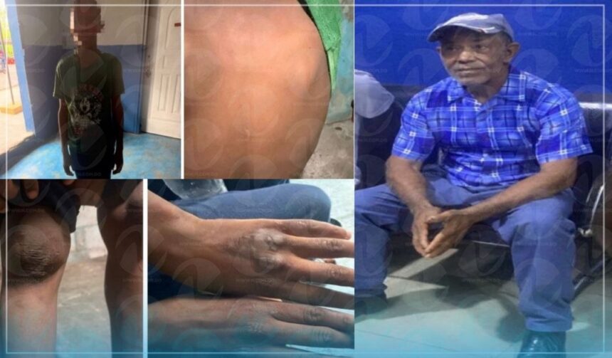 Menores rescatados en SC eran golpeados, quemados, los ponían a pasar hambre y a trabajar forzosamente